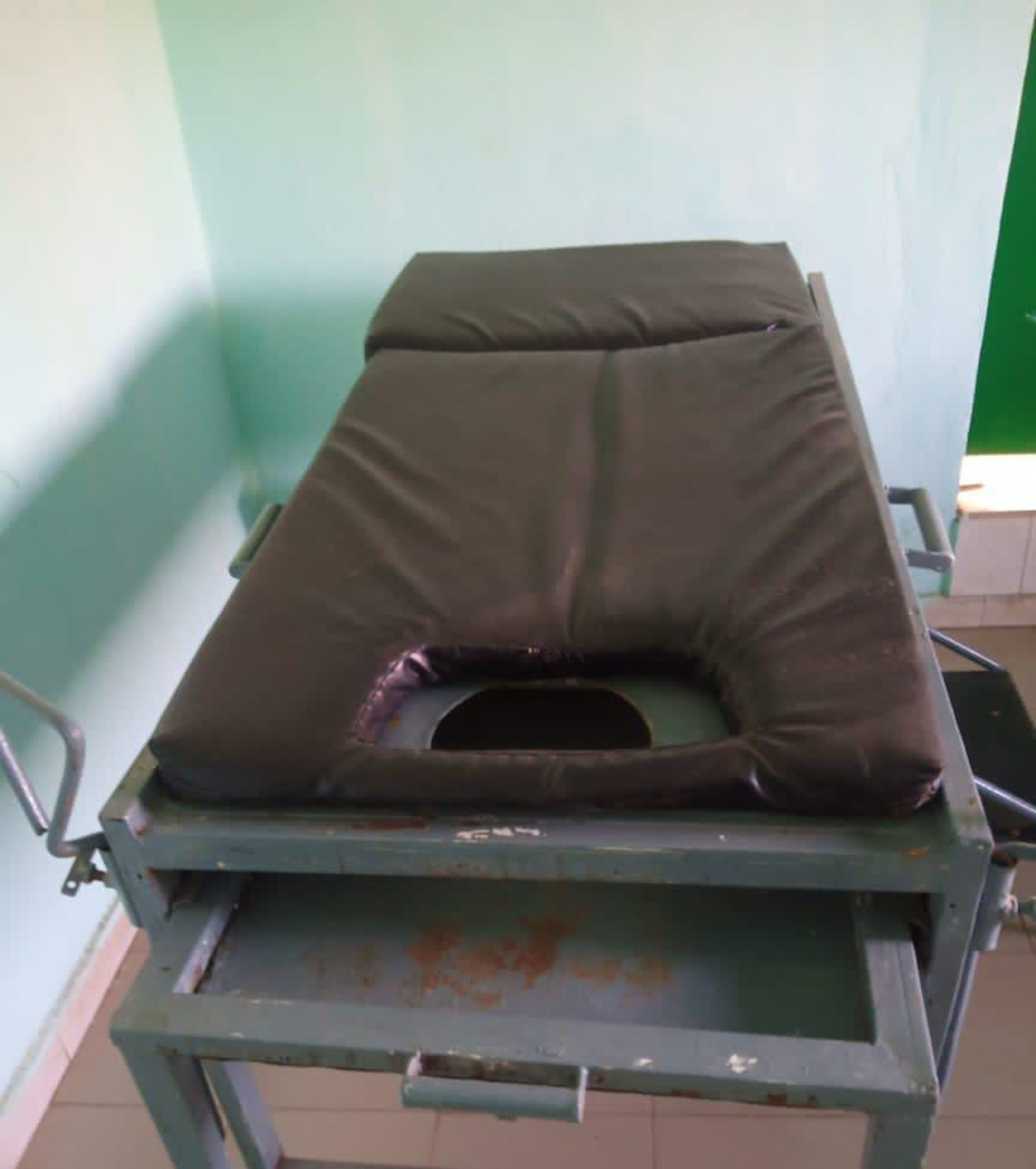 Fistule Obstétricale : la prise en charge reste un défi au Mali