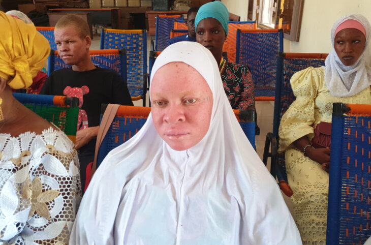 Remise de kits solaire pour les albinos à Diré