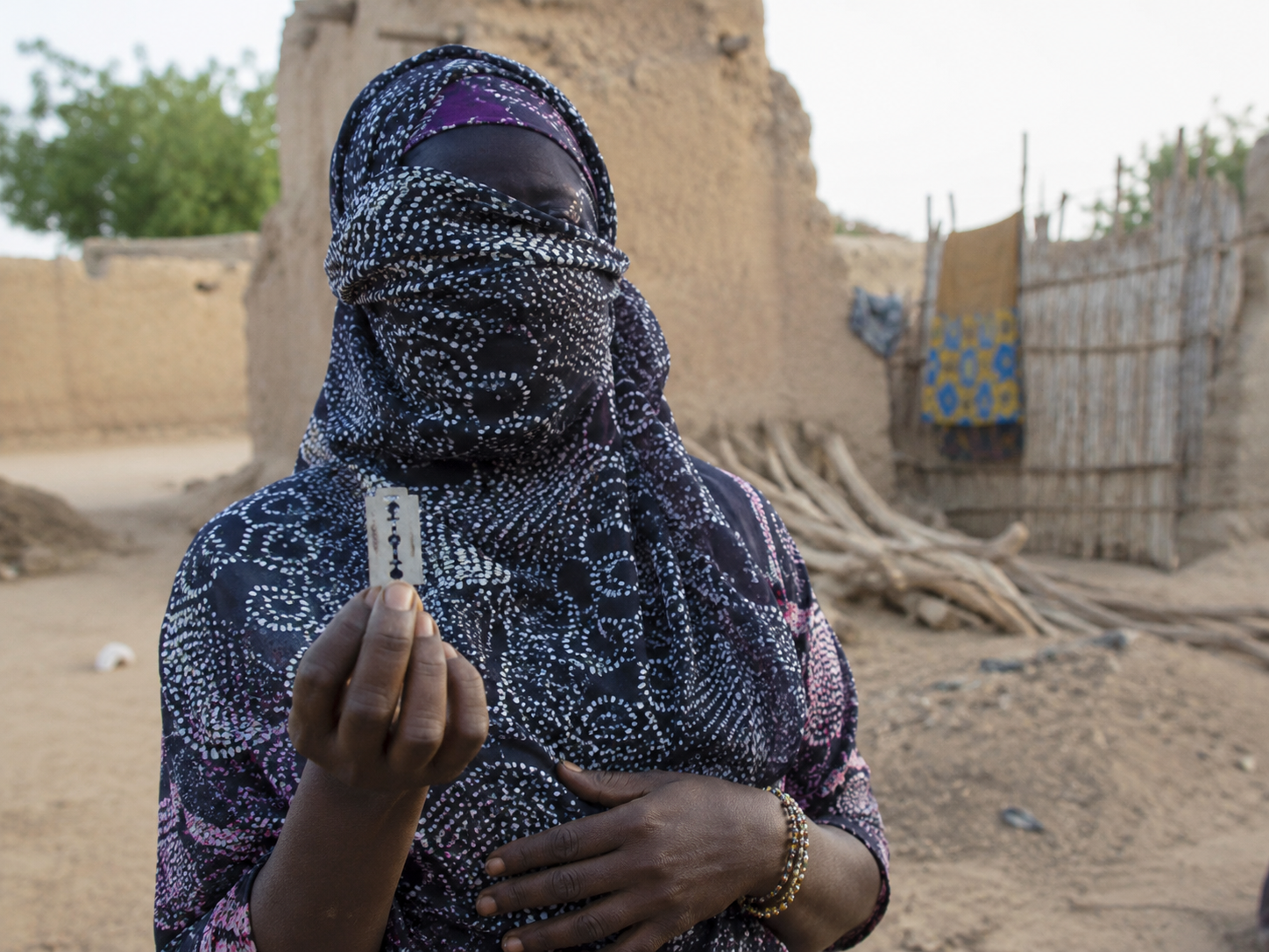 Malgré les progrès, l’excision reste une réalité dans certaines localités du Mali