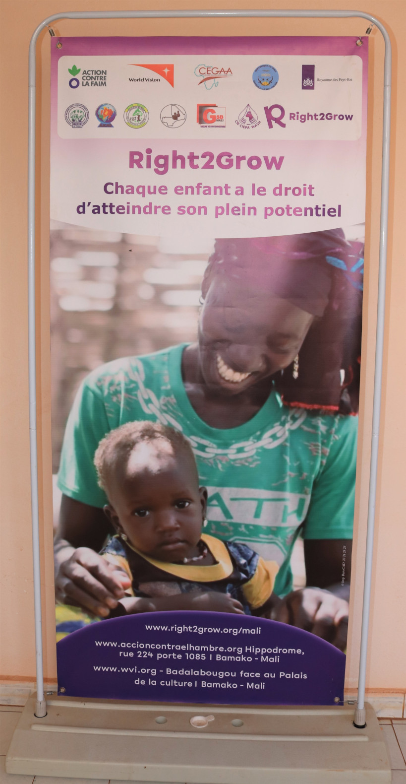 23,7% des enfants de moins de 5 ans touchés par la malnutrition aiguë au Mali