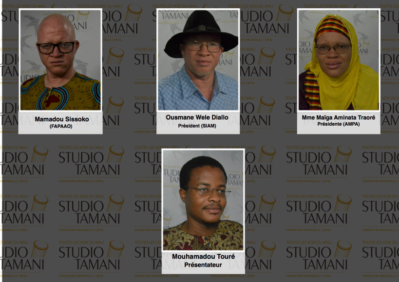 Quelles mesures pour protéger les enfants atteints d’Albinisme ?