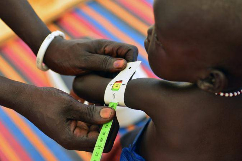 Kita : environ 3200 cas de malnutrition enregistrés en 2021
