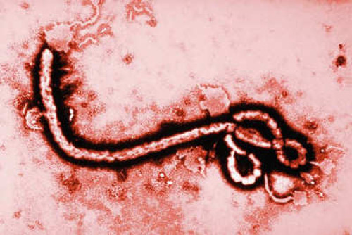 Expérimentation au Libéria d’un sérum contre le virus Ebola
