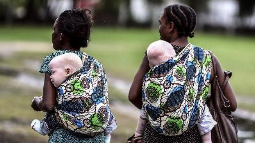Le Magazine du 13 Juin 2016 : Albinos du Mali, à la recherche de protection