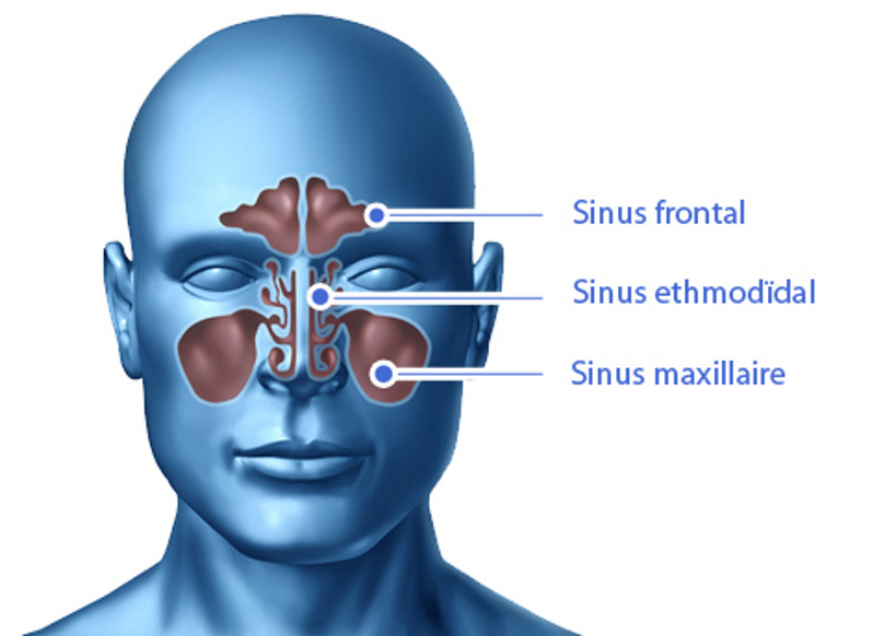 Sinusite : « un malade sur deux affecté par la maladie »